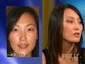 K tells Montel about asian nose eyelid plastic surgery K tells Montel about asian nose eyelid plastic surgery