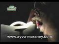 videos de Tä'i Ñemonguera - Odontólogo - Dentist - Odontology - Caries