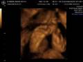 videos de babyhermano