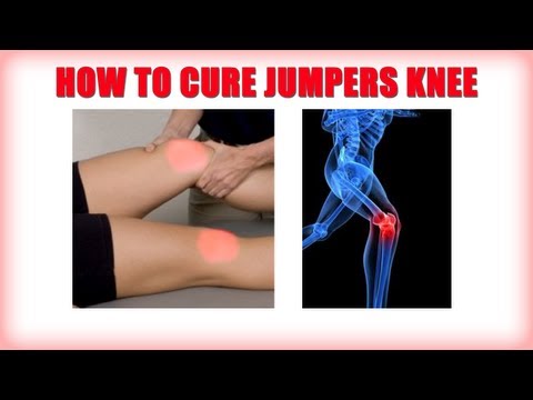how to relieve jumper's knee