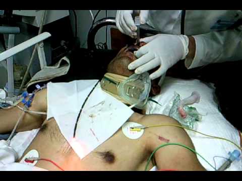 how to care ventilator patient