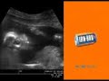 Irn Bru Ad