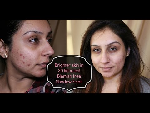 how to lighten acne marks