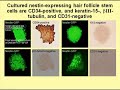Stem cells in hair follicle that repair nerves - Part 1