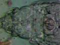 videos de Rotifer Digestive Tract