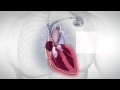 RECORD Study Proves Efficacy and Safety of BIOTRONIK Closed Loop Stimulation (CLS) Pacemaker Therapy