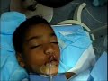 Operation smile in qena