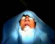 Operation smile in qena