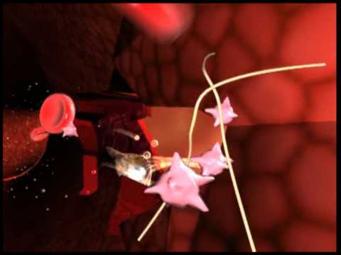 A computer-generated movie on hemophilia ou l'hémophilie en images de synthèse.mpg