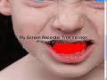 Ph0TosHooP  Transformation "Zomb!3 B0y"