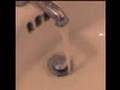 Fluoride Risks for Kidney Patients