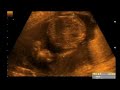 Mi Sobrino Ignacio Andrés-1° Parte Mi Sobrino Ignacio Andrés-1° Parte