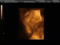 3D/4D Ultrasound at 29 Weeks Pregnant! (Part 2)