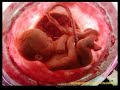 development of child.