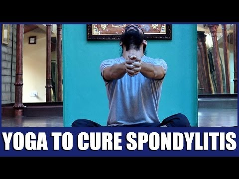 how to cure spondylitis