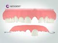 IMPLANTES DENTARIOS IMPLANTES DENTARIOS