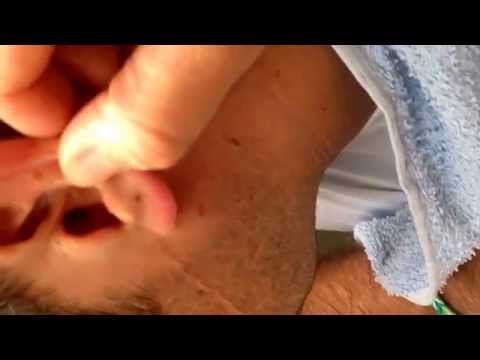 how to drain ear wax at home
