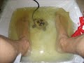 Remove Toxins by Foot Detox - Day 4 Remove Toxins by Foot Detox - Day 4