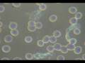 videos de Sangre despues tratamiento Geocrom