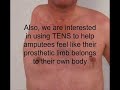 Can electrical stimulation of the skin reduce pain? Can electrical stimulation of the skin reduce pain?