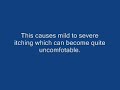 How to cure a yeast infection What is Yeast Infection Vaginal Yeast Infections