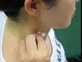 Trigger Point Injection 筋痛症の局所麻酔治療 (むちうち)