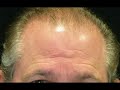 3s minoxidil 5% magic formula hair regrowth treatment unisex