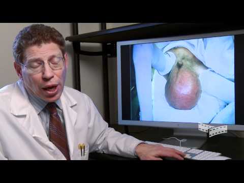 Penectomy - WARNING: Explicit Content. The Following footage contains graphic images of mutilated male genitalia. Watch and listen to the visually striking and bizarre p...