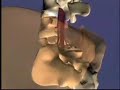 Fwd: Erik Dalton Myoskeletal Alignment Techniques @ http://ow.ly/bqtP4 (tramite http://ff.im/YeMNu)