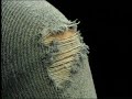 Worn amalgam Filling