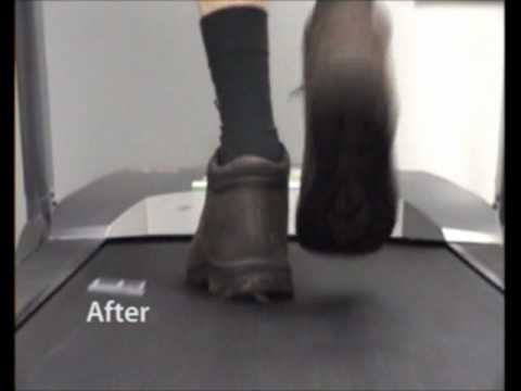 Video Gait Analysis