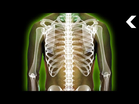 What Does Radiation Poisoning Do to Your Body?