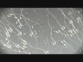 SPERM MAPION TVCM SPERM MAPION TVCM
