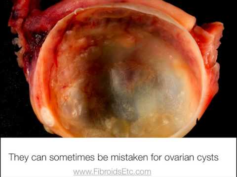 how to dissolve atorvastatin