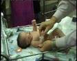 Dr. Ganel performs Pediatric orthopedic examination