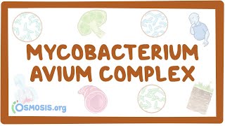 Mycobacterium avium complex - causes symptoms diag