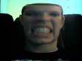 Mediasmart Webcam Distortions