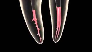 Endodoncia