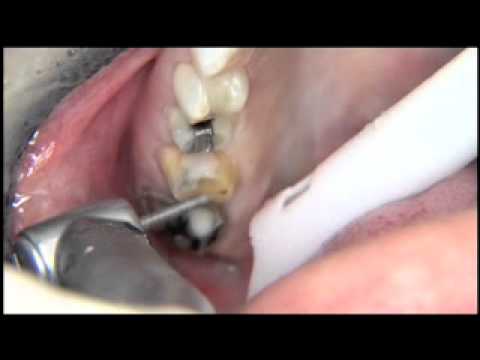 See video