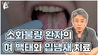 소화불량 환자의 혀백태와 입냄새 치료 사례