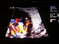 16w6 day u/s