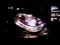 16w6 day u/s