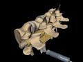 3D Animation of performing epidural anesthesia 3D Animation of performing epidural anesthesia