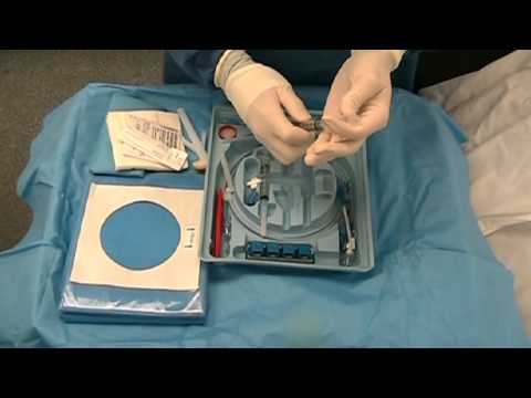 how to locate ijv