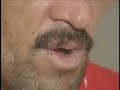 15 minutos especial psiquiatria parte 02