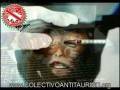 Ska-p Animales de laboratorios.mpg