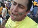TIGRES VS ATLANTE 2 / 4 TIGRES VS ATLANTE 2 / 4