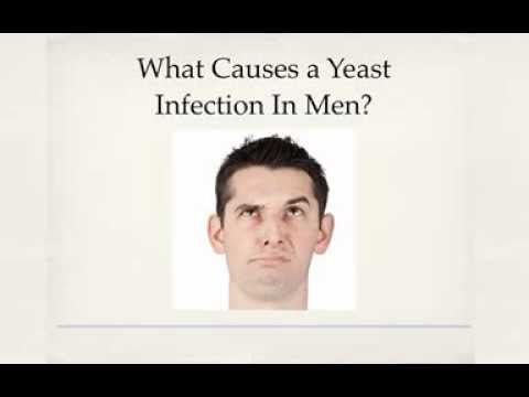 how to cure yeast infection on a man