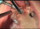 Cirugia NobelGuide