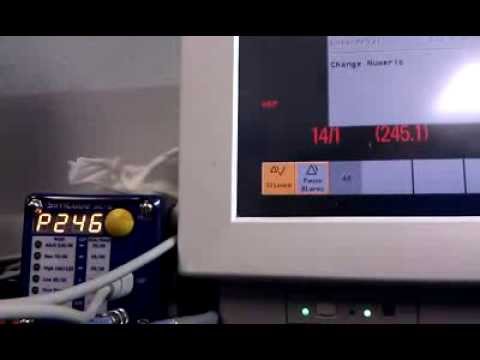 how to perform cuff leak test
